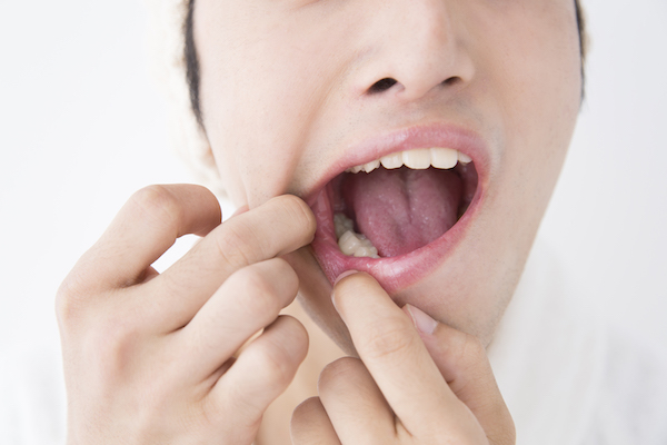 虫歯のリスクが高まる